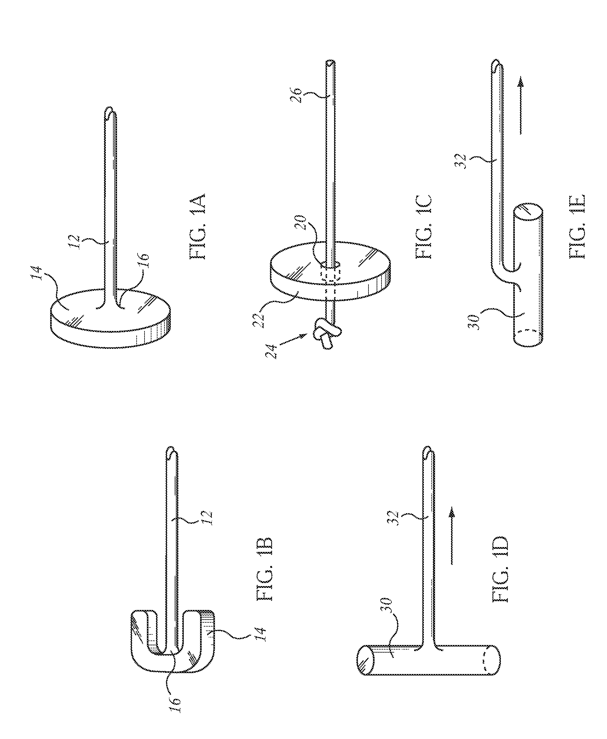 Closed Loop Gastric Restriction Devices and Methods