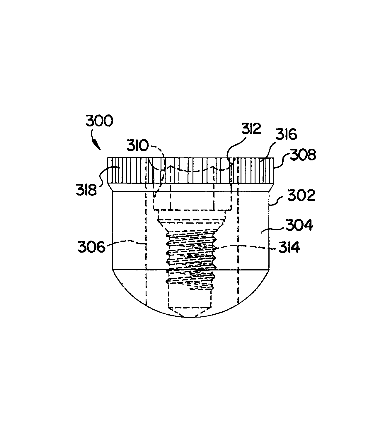 Dental implant for a jaw with reduced bone volume and improved osseointegration features