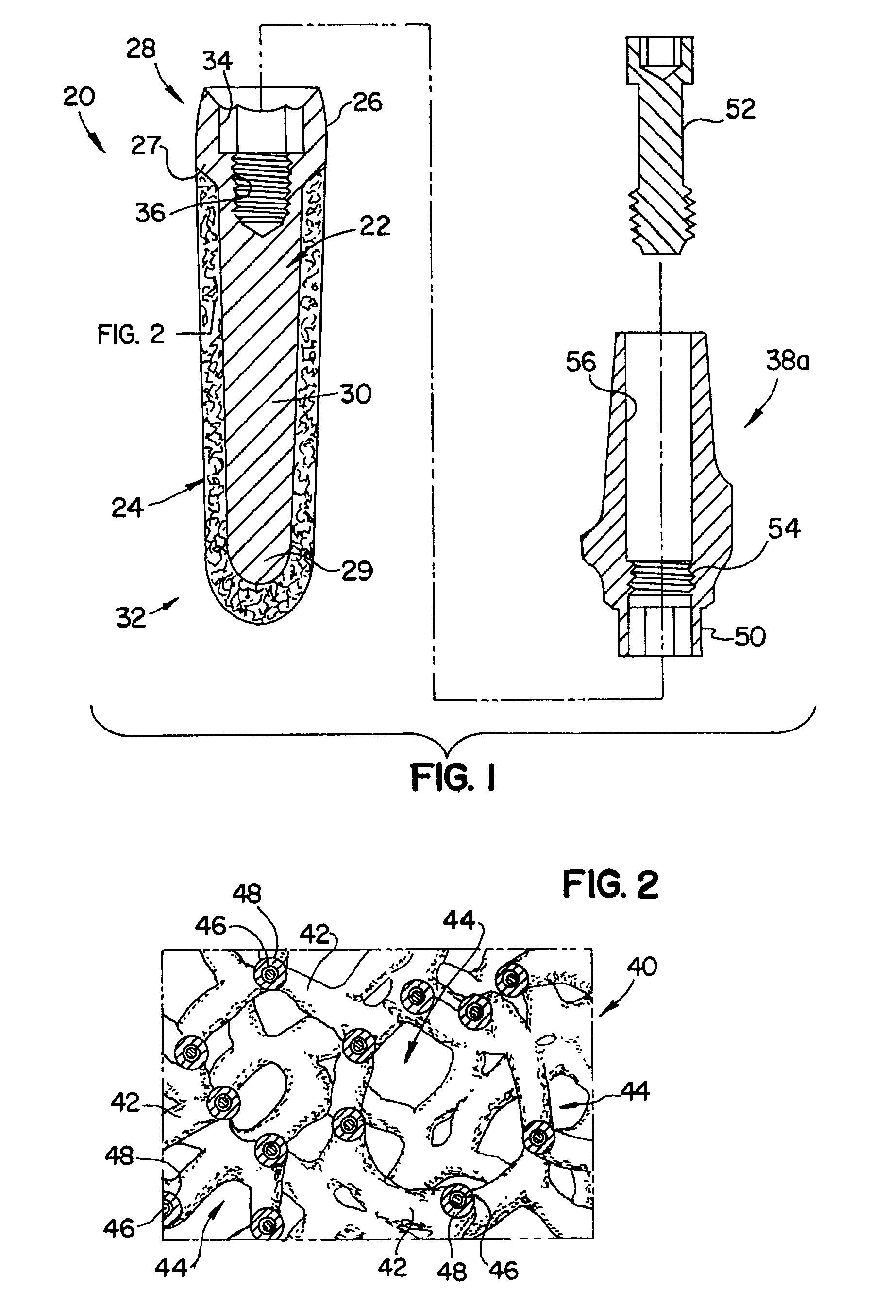 Dental implant for a jaw with reduced bone volume and improved osseointegration features