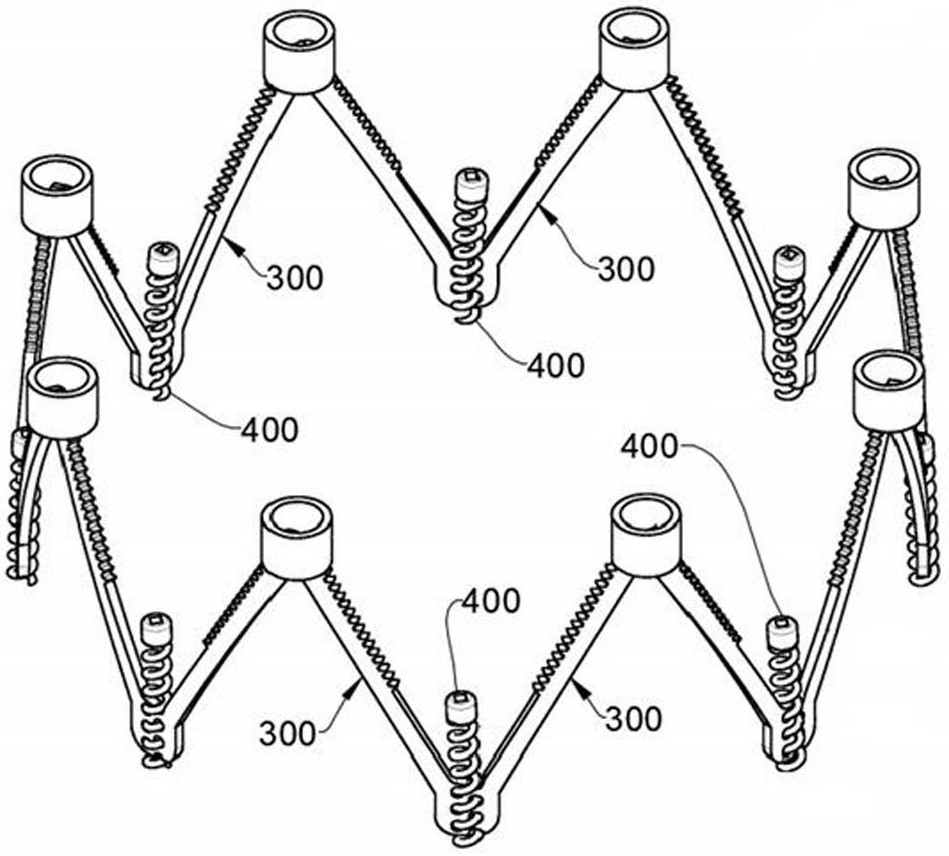 Mitral valve repairing and implanting system