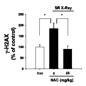 Application of N-acetylcysteine in preparation of drugs for preventing and treating DNA damage and tissue damage induced by synchrotron radiation