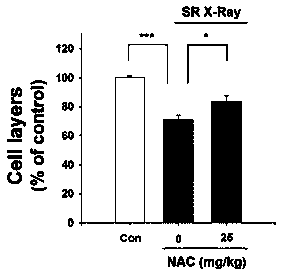 Application of N-acetylcysteine in preparation of drugs for preventing and treating DNA damage and tissue damage induced by synchrotron radiation