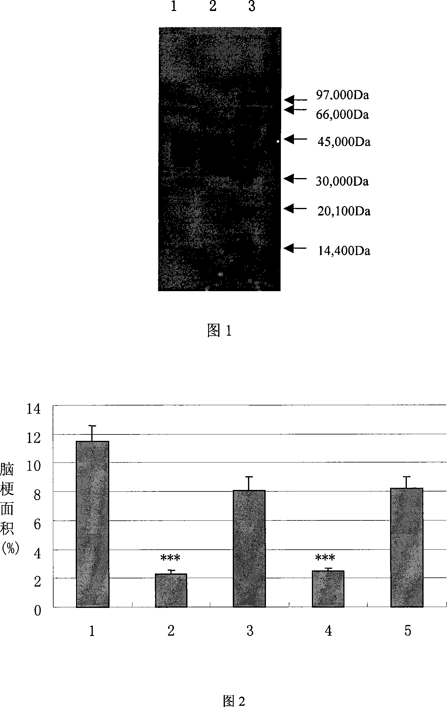 Pharmaceutical composition containing recombination human pancreatic kininogenase for treating and/or preventing cerebral infarction