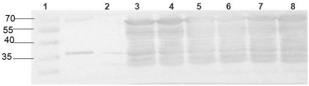 Immunogenic polypeptide for enterovirus 71 type VP1 antigen as well as preparation method and application of immunogenic polypeptide