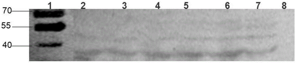 Immunogenic polypeptide for enterovirus 71 type VP1 antigen as well as preparation method and application of immunogenic polypeptide