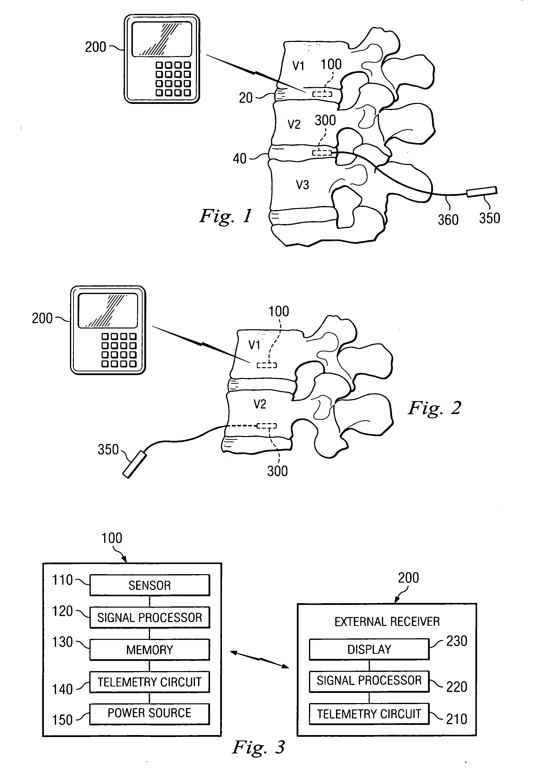 Dynamic treatment system and method of use