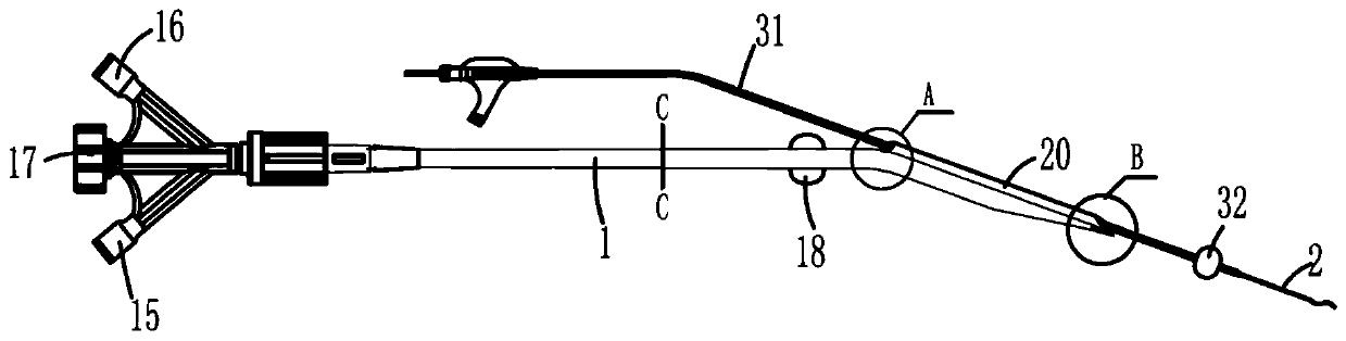 Thrombus treatment system