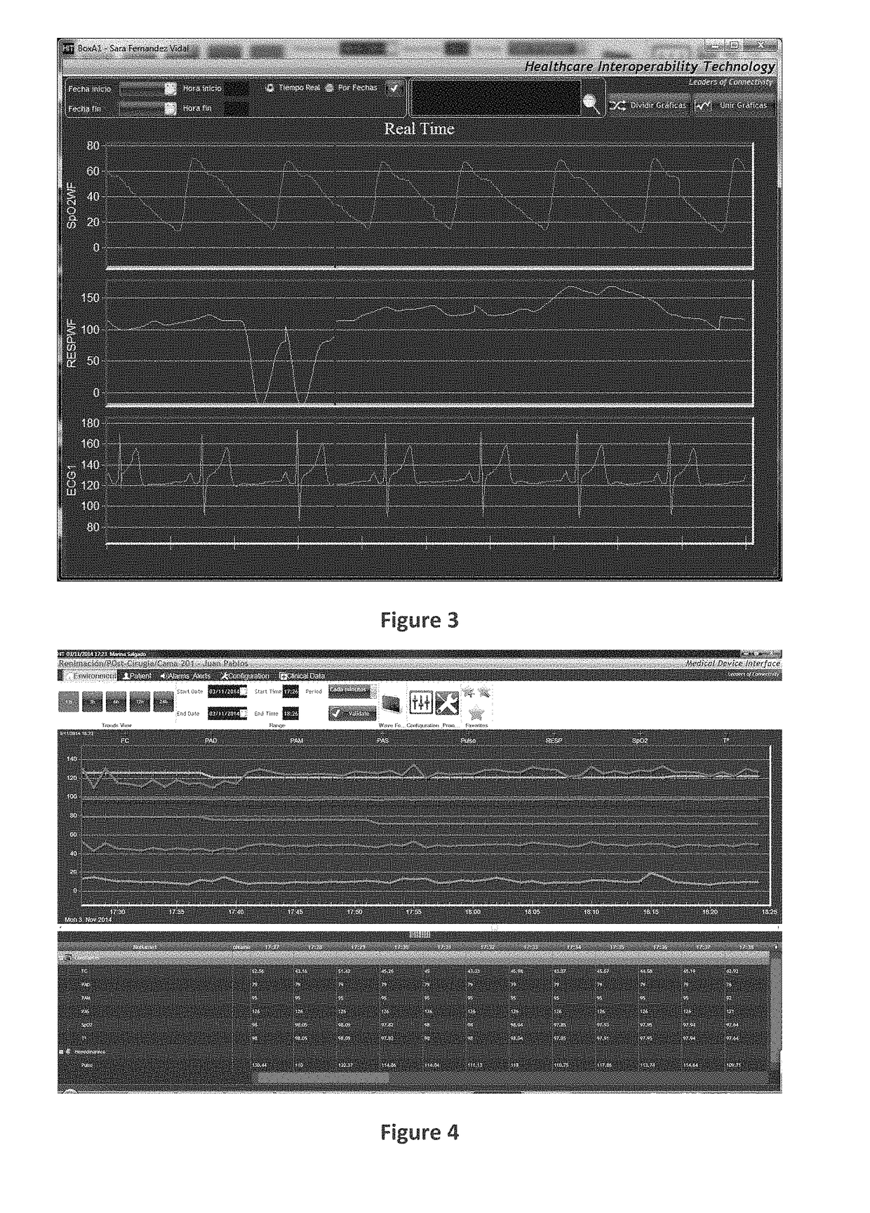 System for acquisition, processing and visualization of clinical data of patients