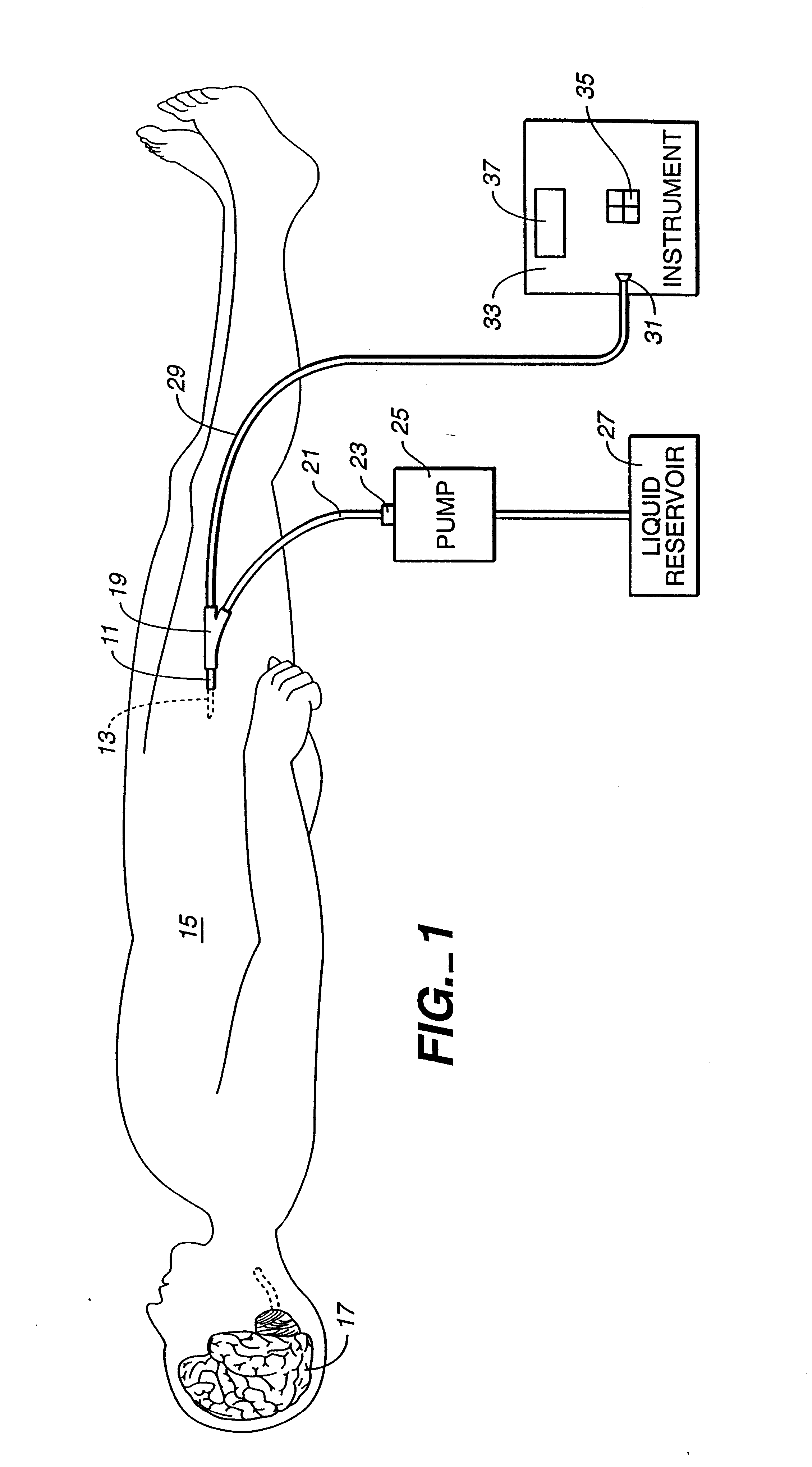 Photoacoustic removal of occlusions from blood vessels