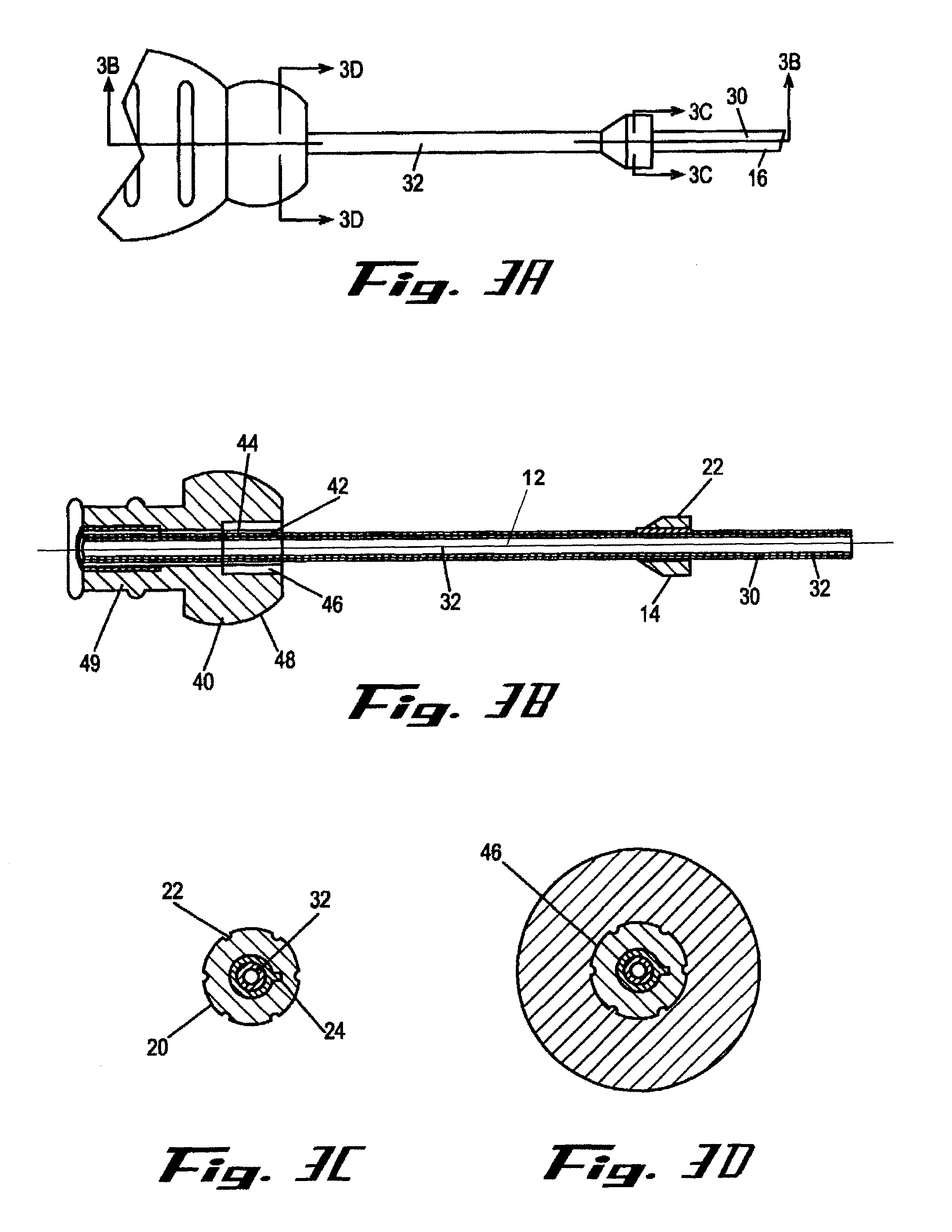 Medical appliance optical delivery and deployment apparatus and method