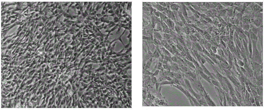 Method and kit for acquiring amniotic mesenchymal stem cells