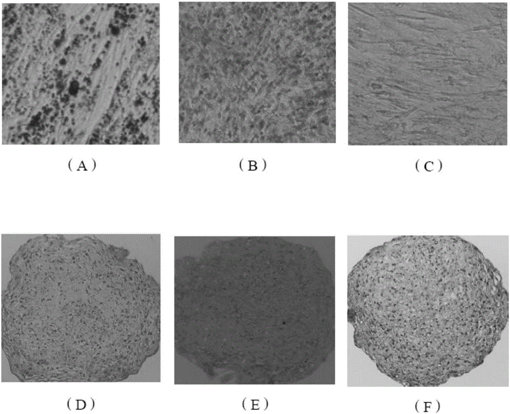 Method and kit for acquiring amniotic mesenchymal stem cells