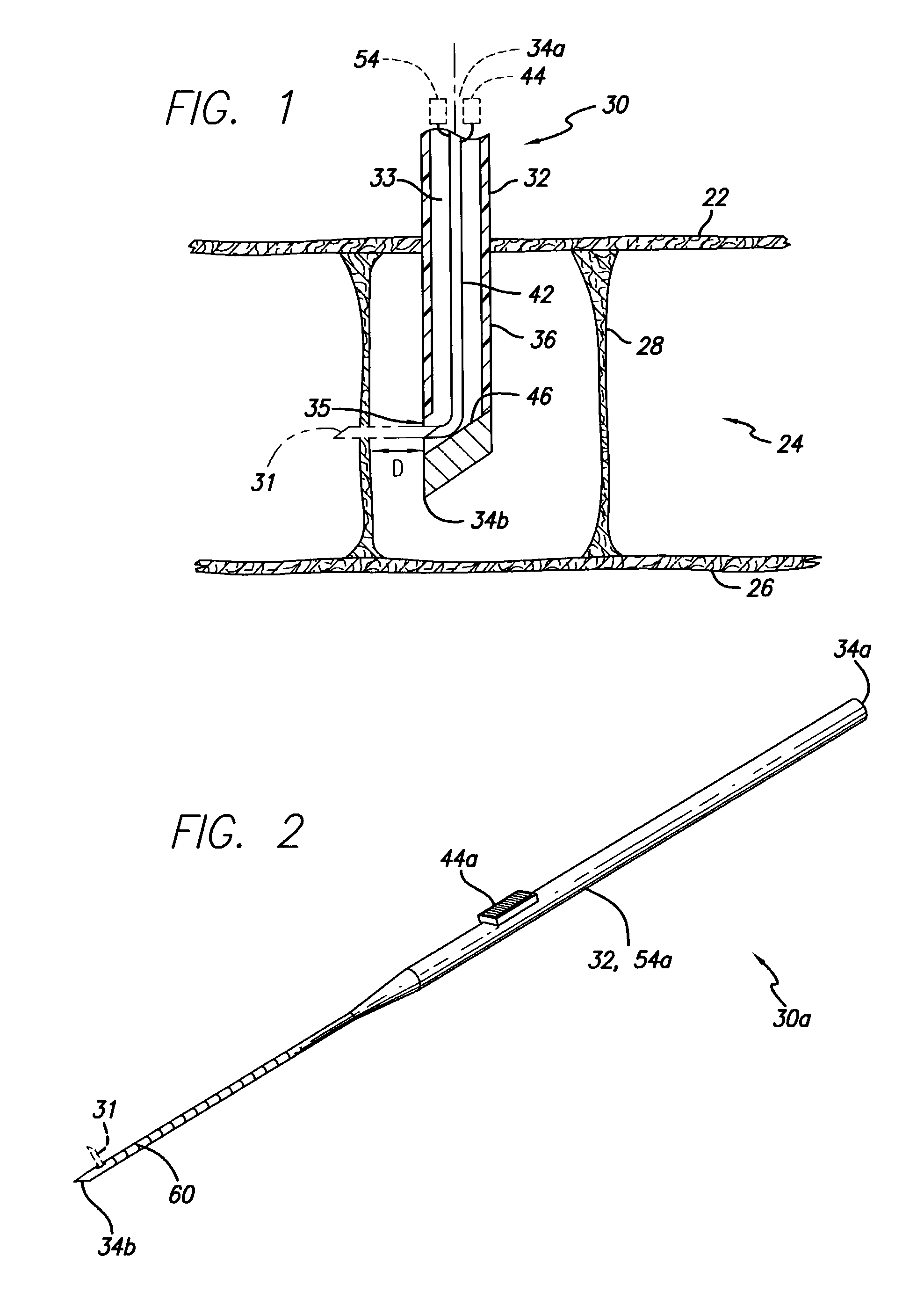 Percutaneous cellulite removal system