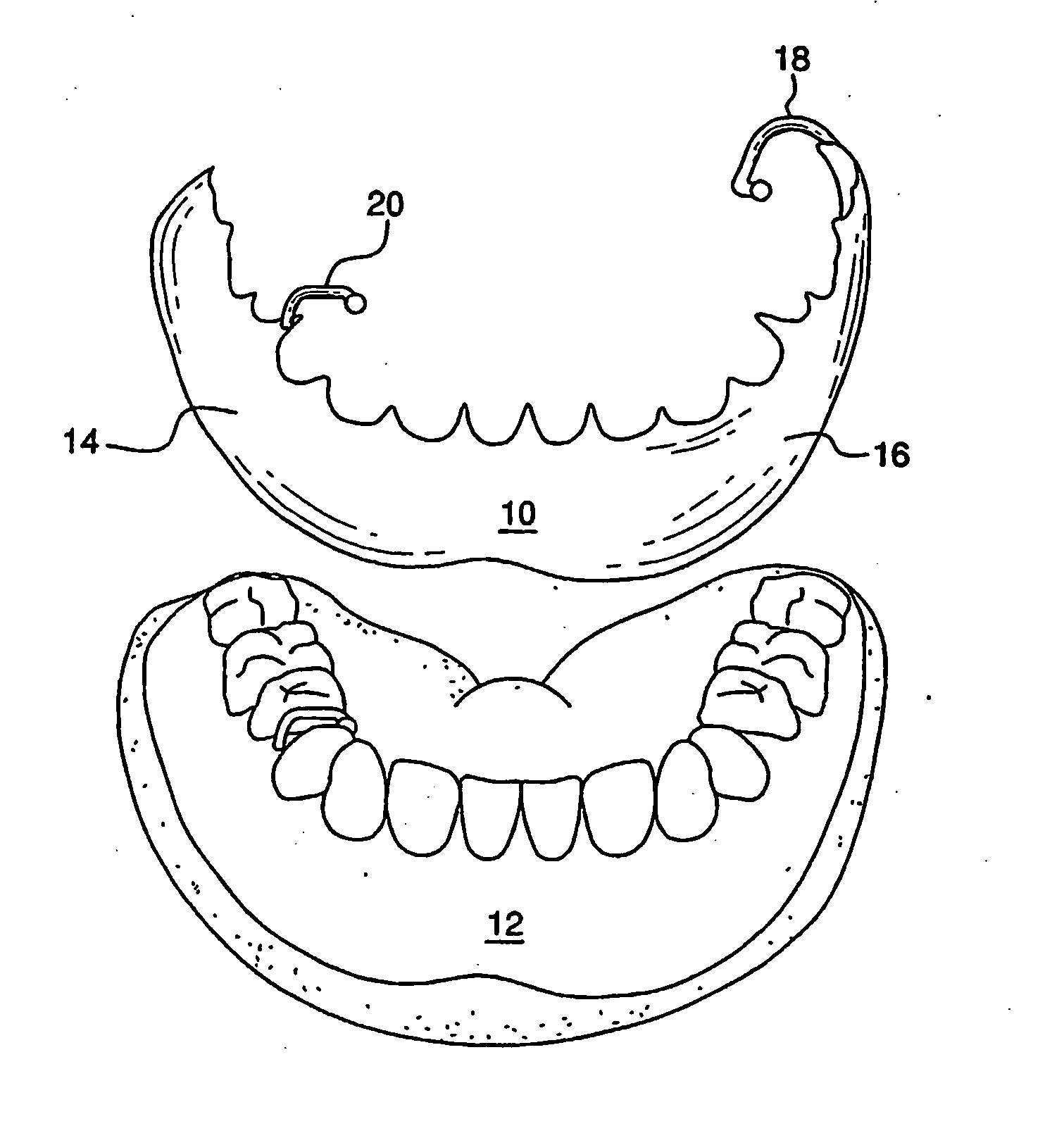 Cosmetic prosthesis and methods for making the same