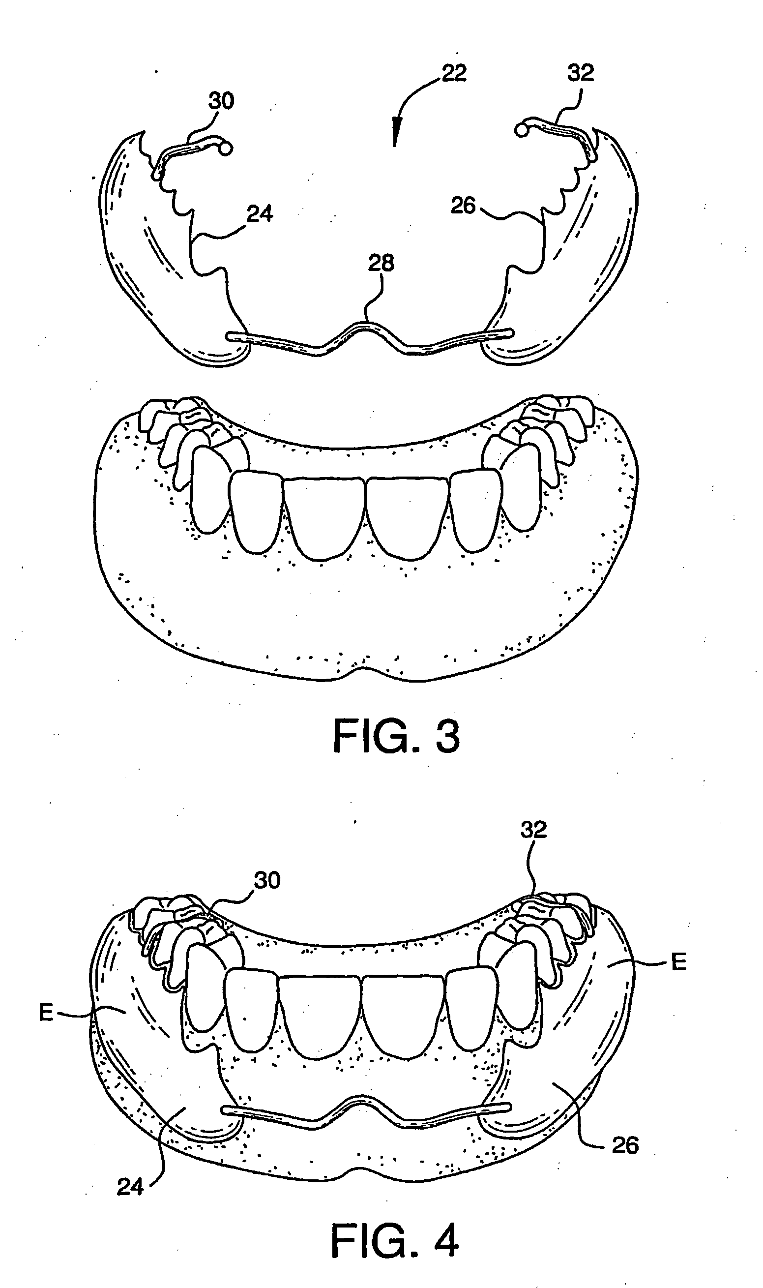 Cosmetic prosthesis and methods for making the same