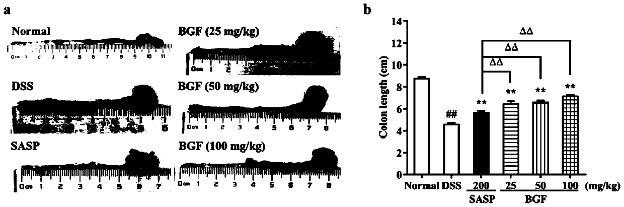 Application of bruguiear gymnorrhiza fruit in preparation of drug for preventing and treating acute ulcerative colitis