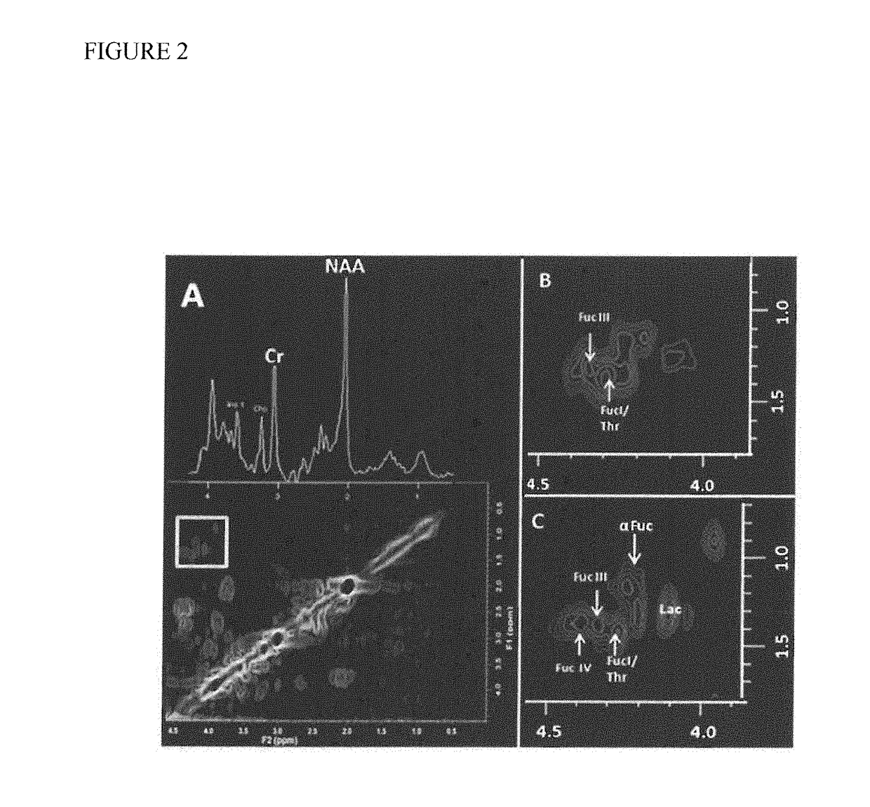 Method and system for detecting and identifying different types of pain and monitoring subsequent therapy