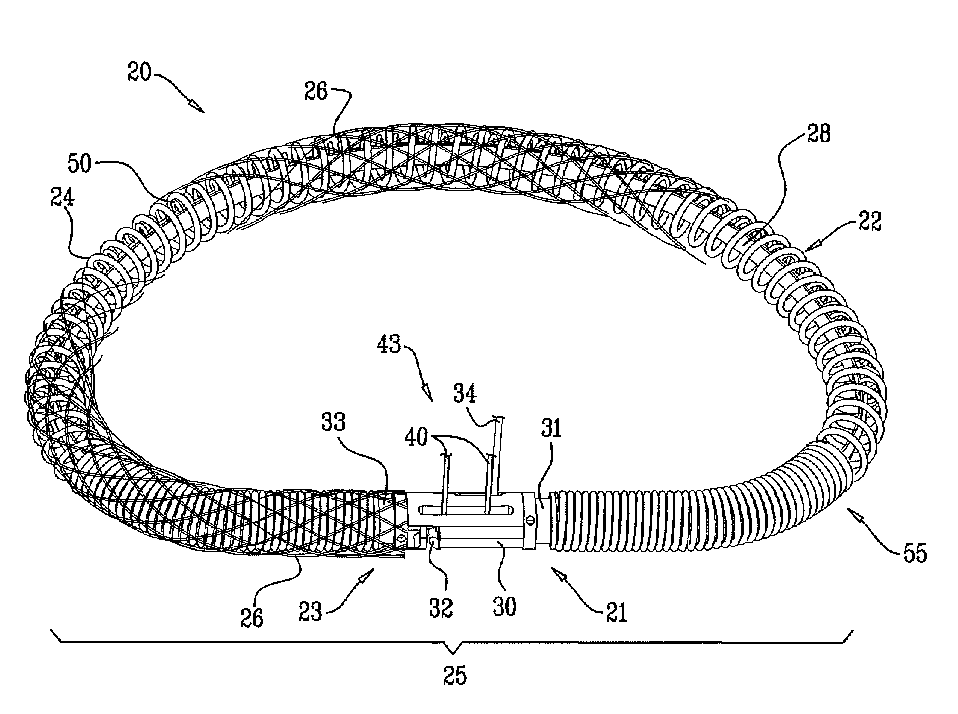 Actively-engageable movement-restriction mechanism for use with an annuloplasty structure