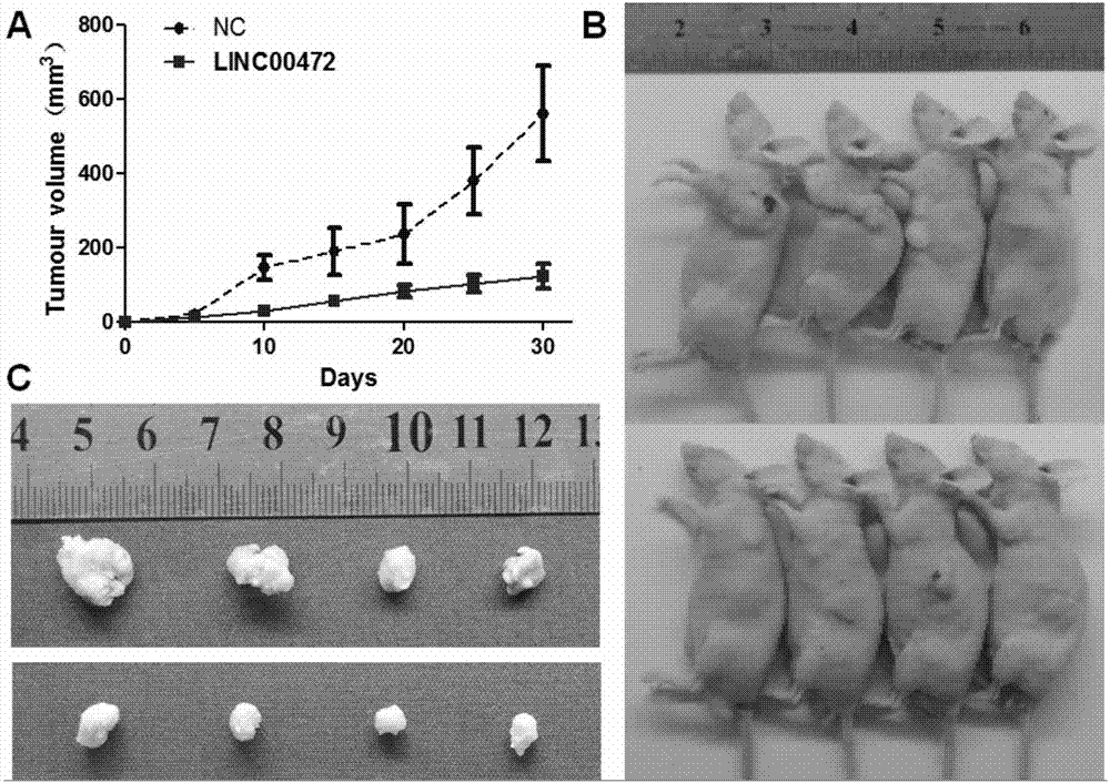 Expression vector of long-chain non-coding RNALINC00472, tumor suppression reagent and application thereof