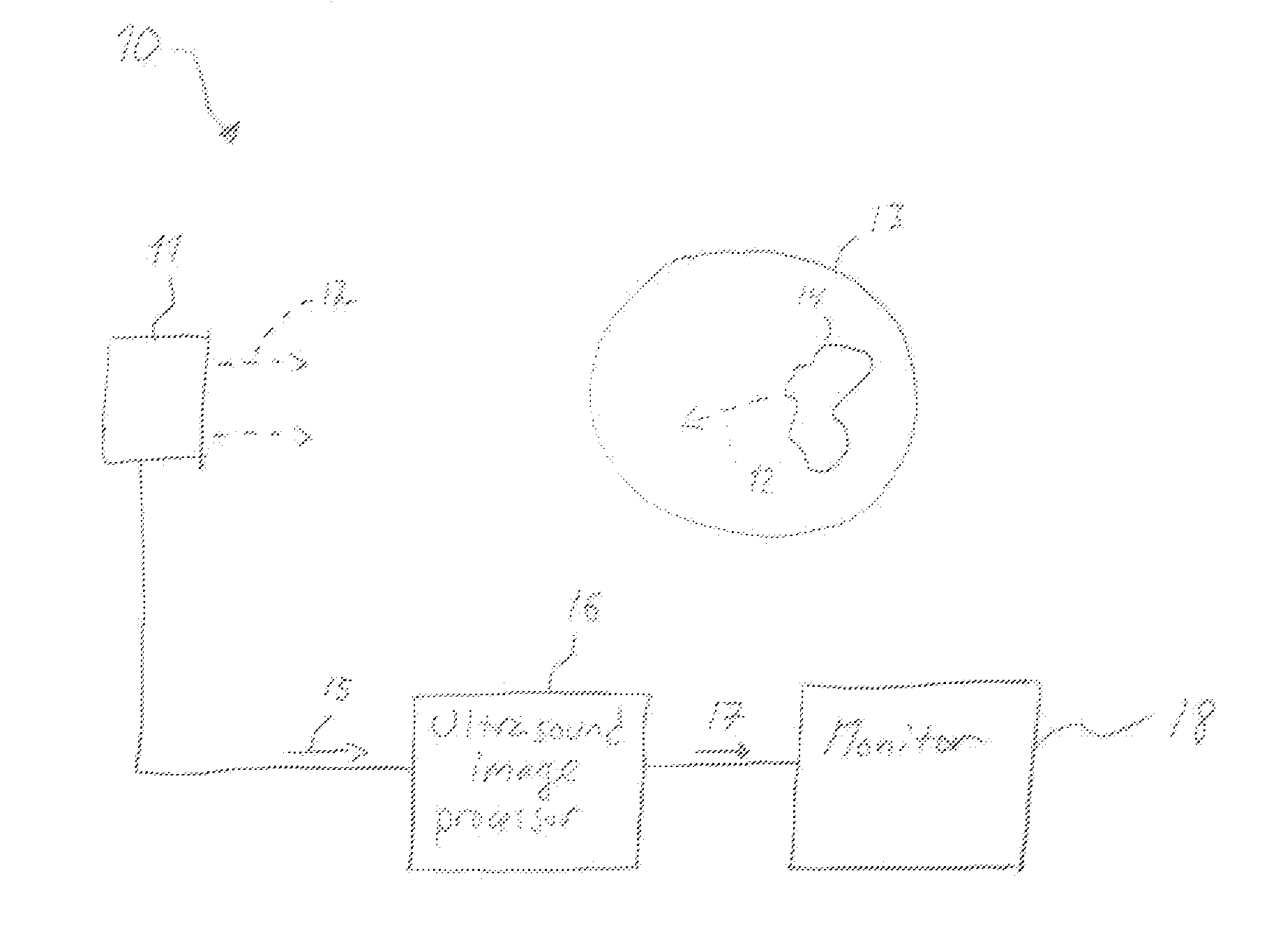 Methods and systems for automatic control of subjective image quality in imaging of objects