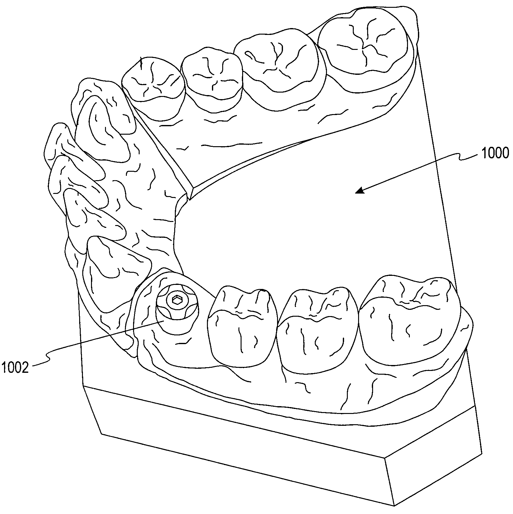 Methods for manufacturing dental implant components