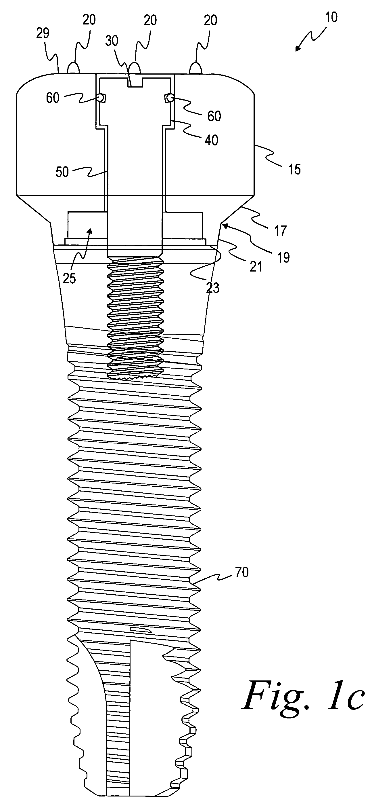 Methods for manufacturing dental implant components