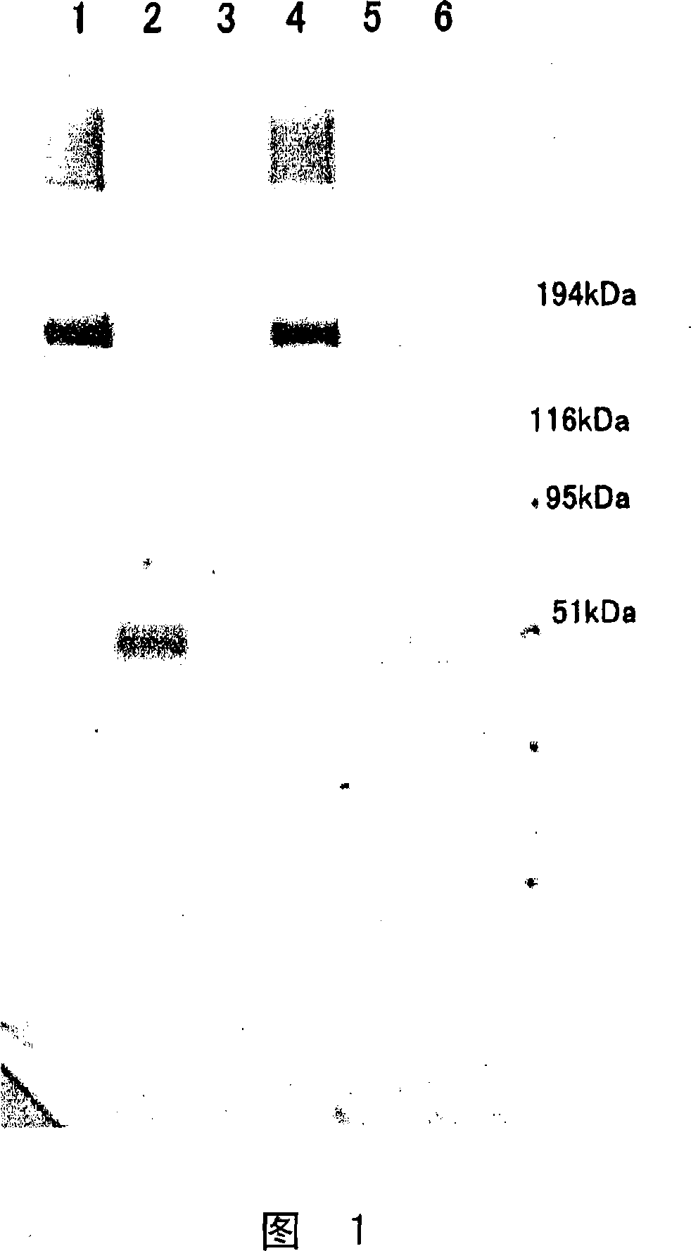 Method of detecting platelet thrombosis or organ injury