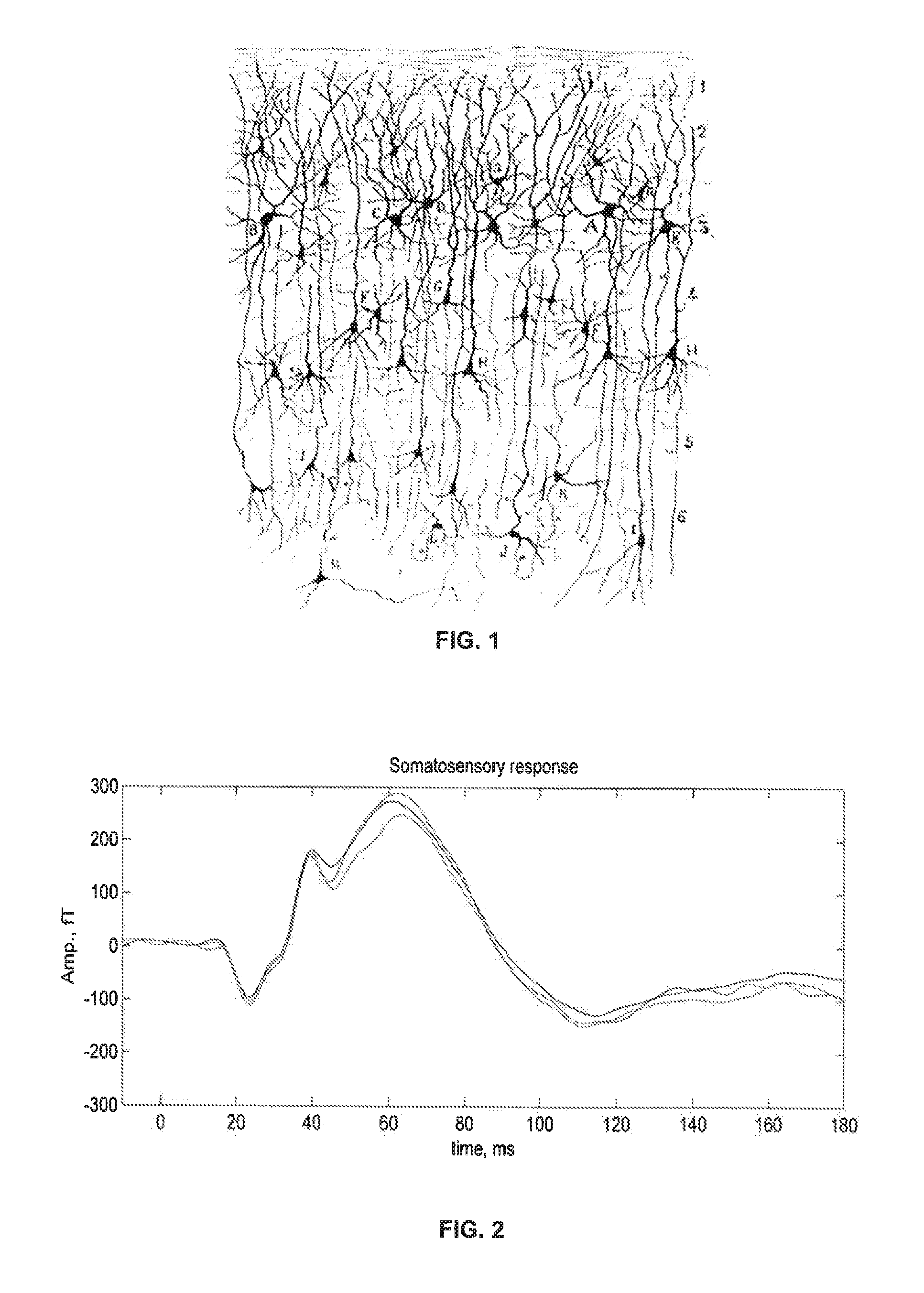 Direct Imaging of Neural Currents Using Ultra-Low Field Magnetic Resonance Techniques