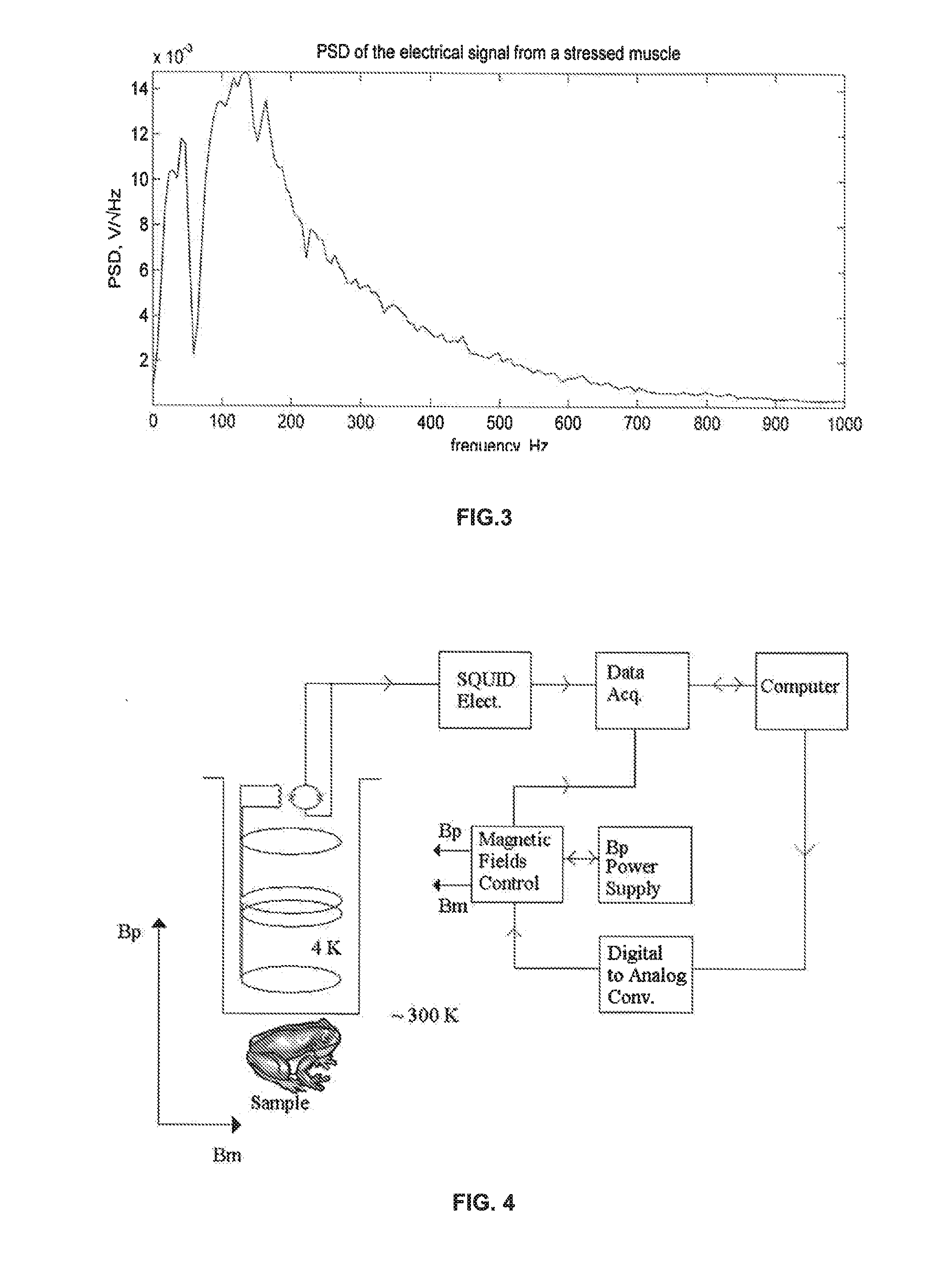 Direct Imaging of Neural Currents Using Ultra-Low Field Magnetic Resonance Techniques