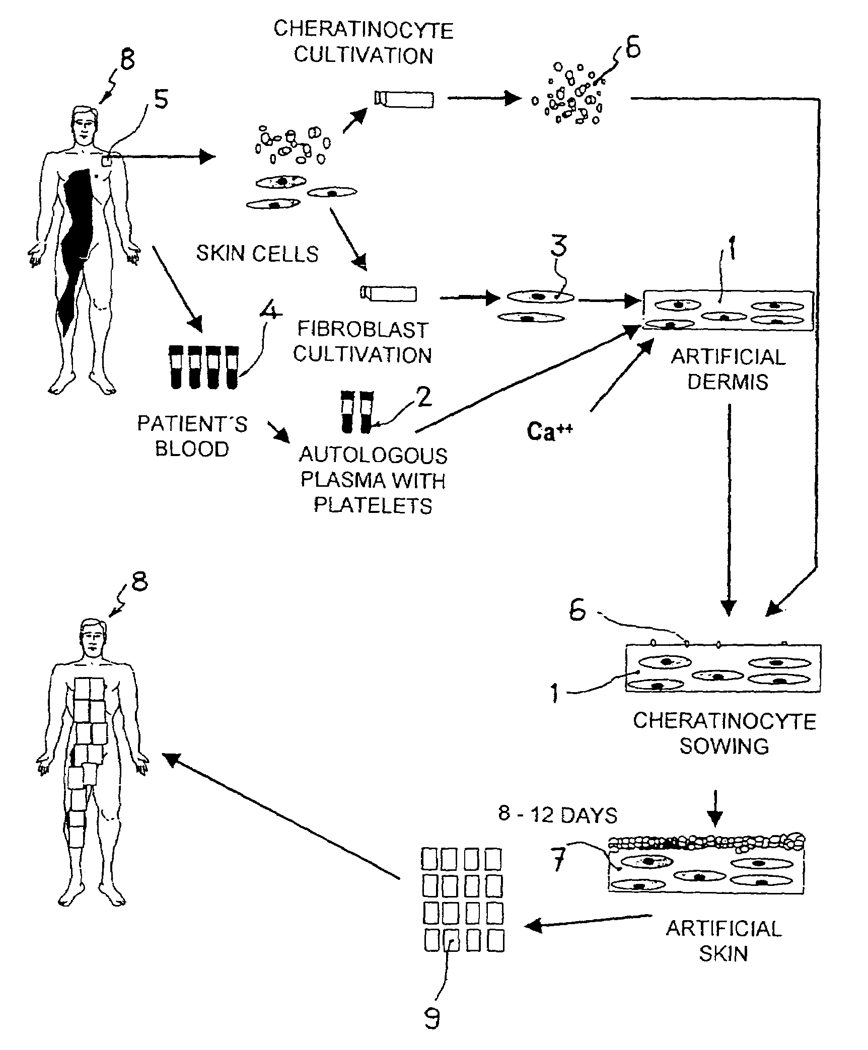 Artificial dermis and production method therefor