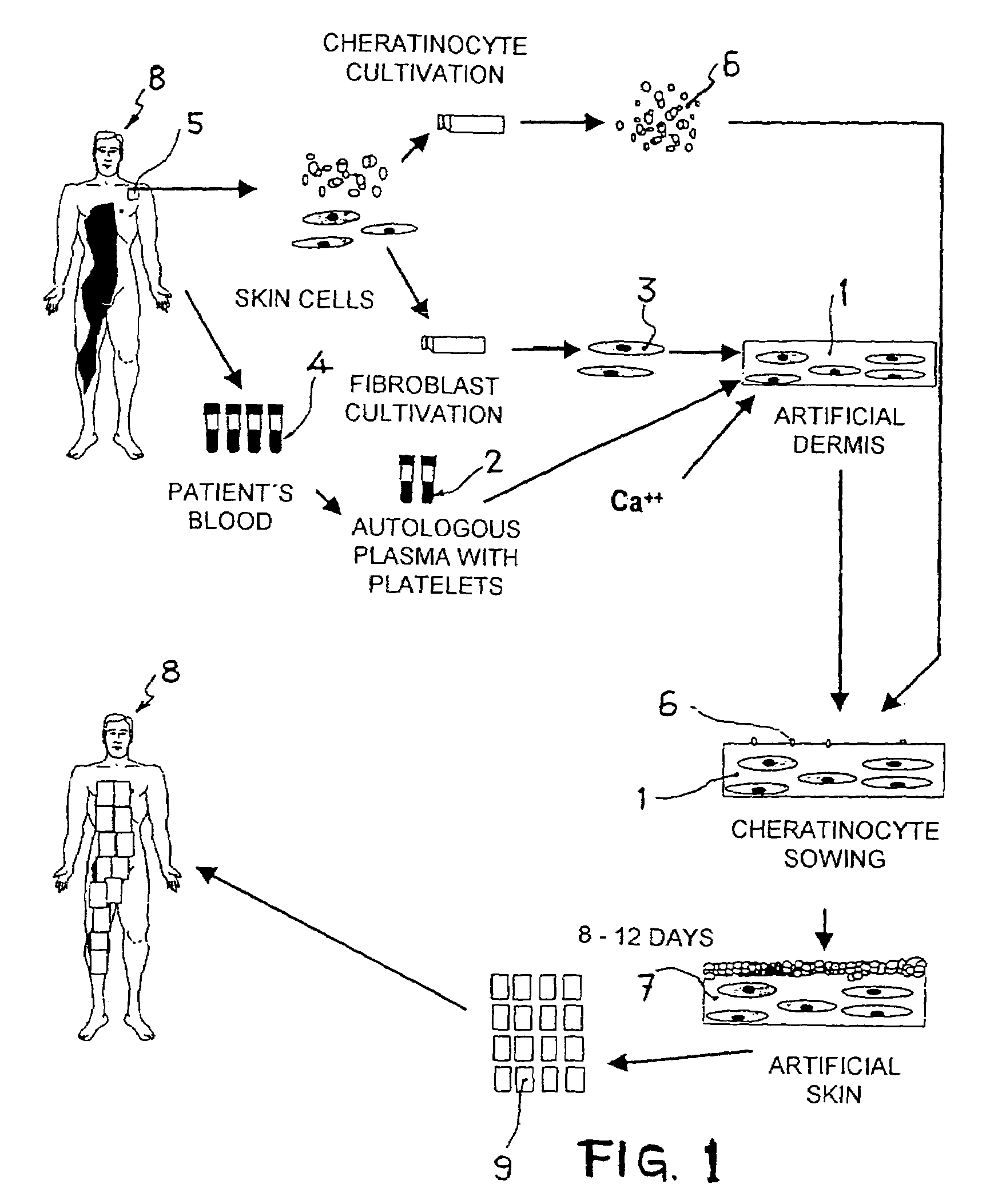 Artificial dermis and production method therefor