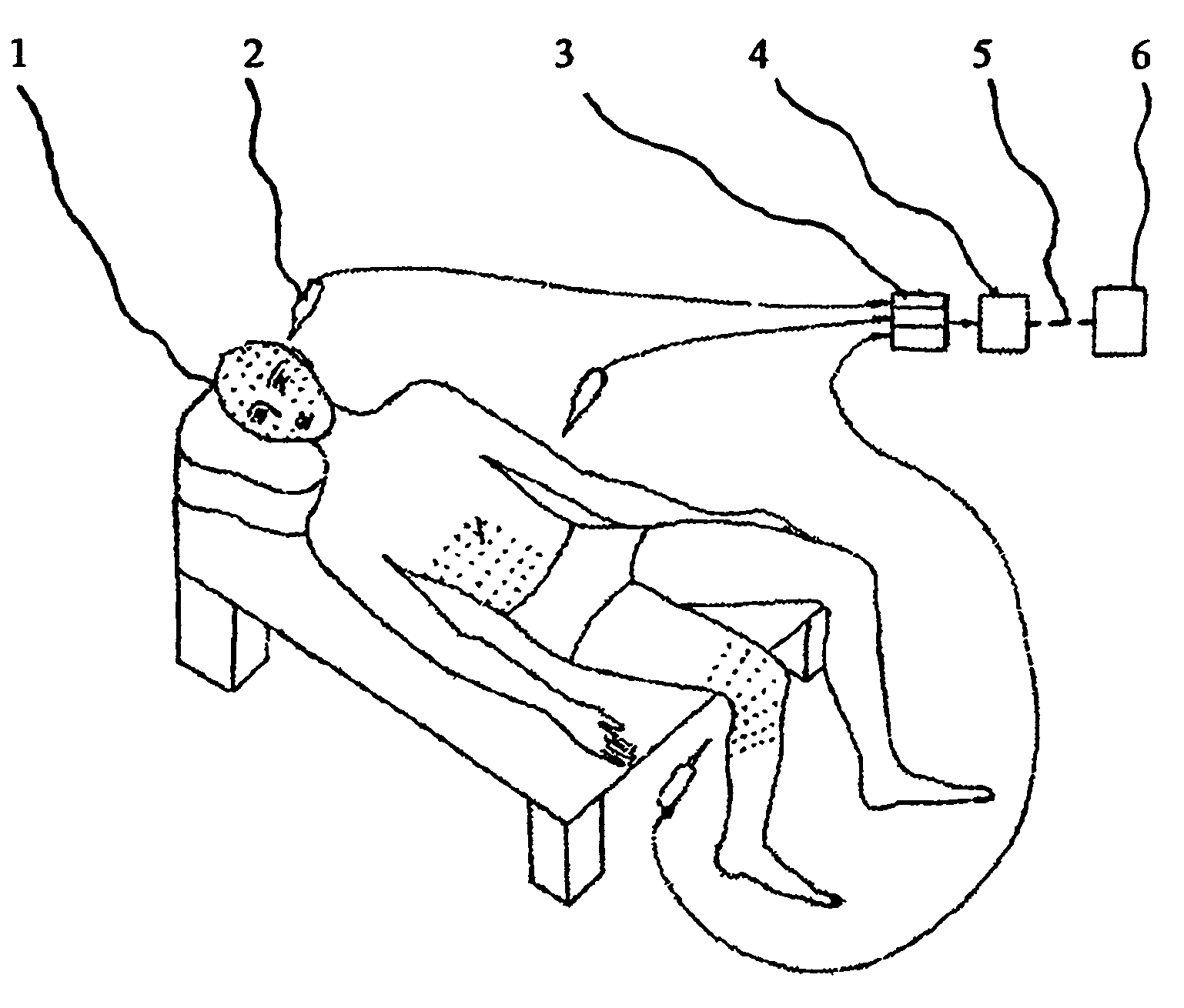 Method for thermal diagnosis of pathology of a bioobject and device for carrying out said method