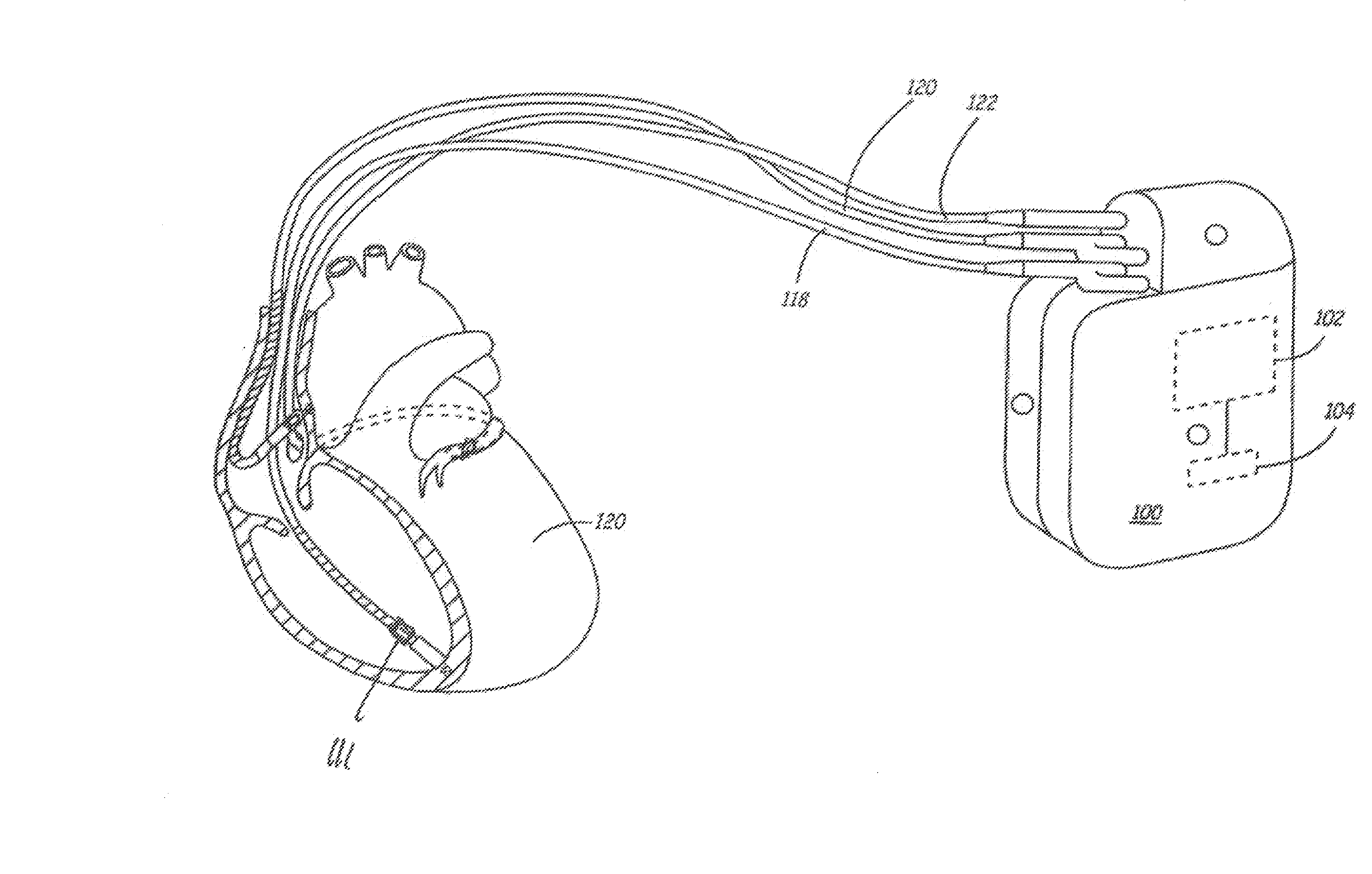 Fault tolerant sensors and methods for implementing fault tolerance in implantable medical devices