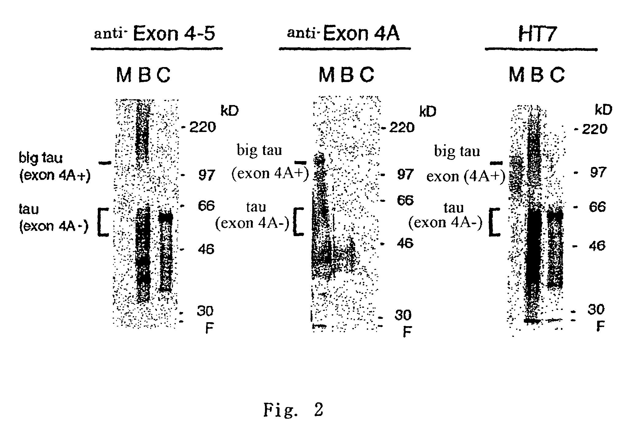 Antibody specific to central nervous system tau protein