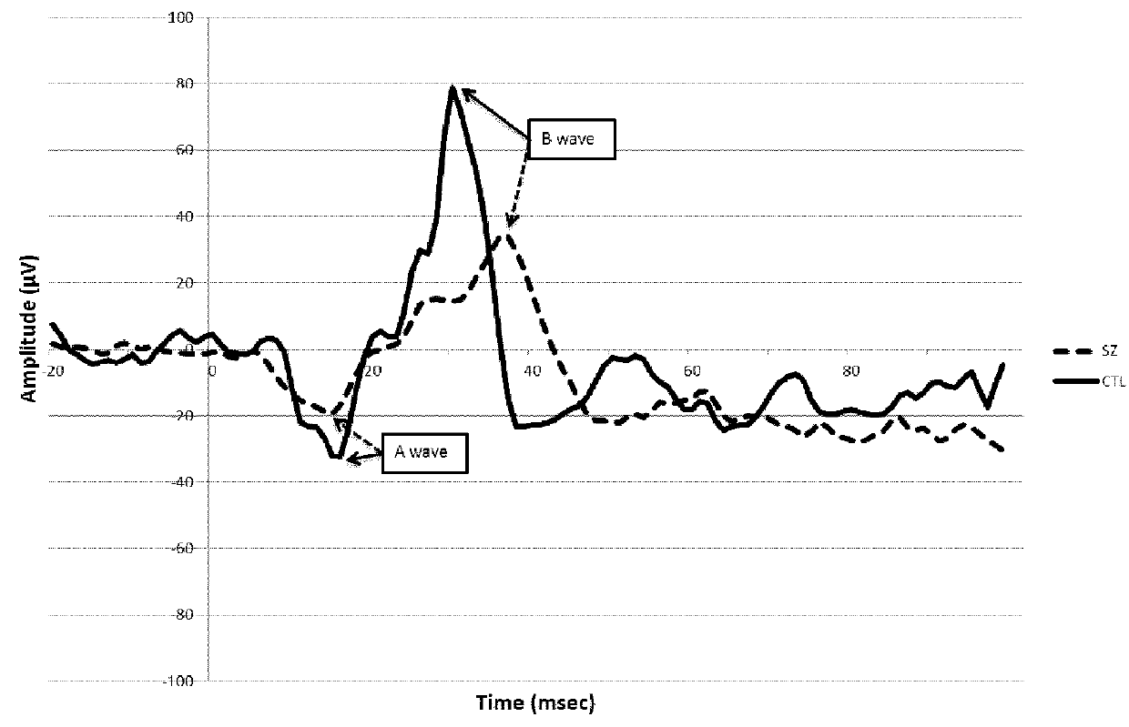 Use of electroretinography (ERG) for the assessment of psychiatric disorders