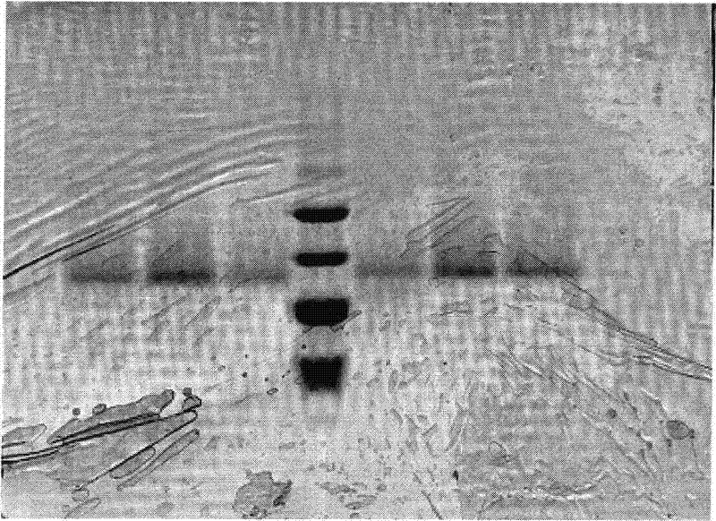 Cobra-venom factor and cobra-venom neurotoxin combined separation and purification method