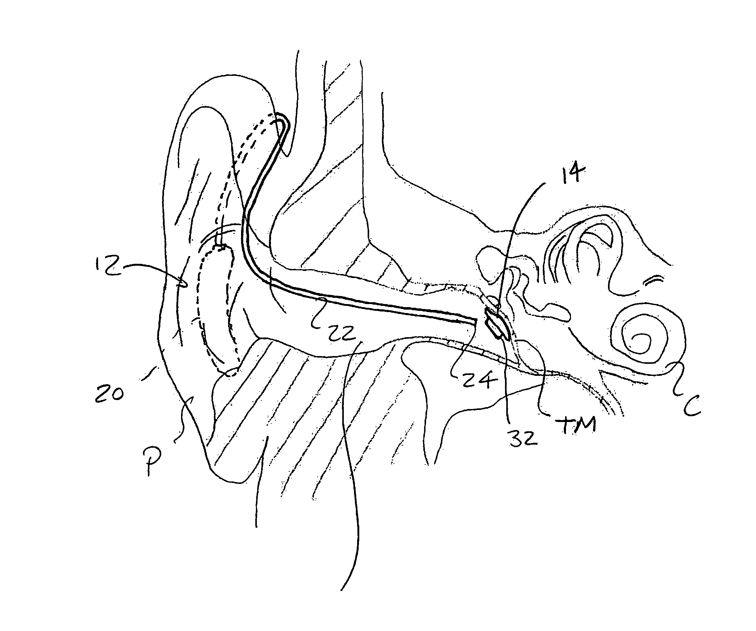 Systems and methods for photo-mechanical hearing transduction