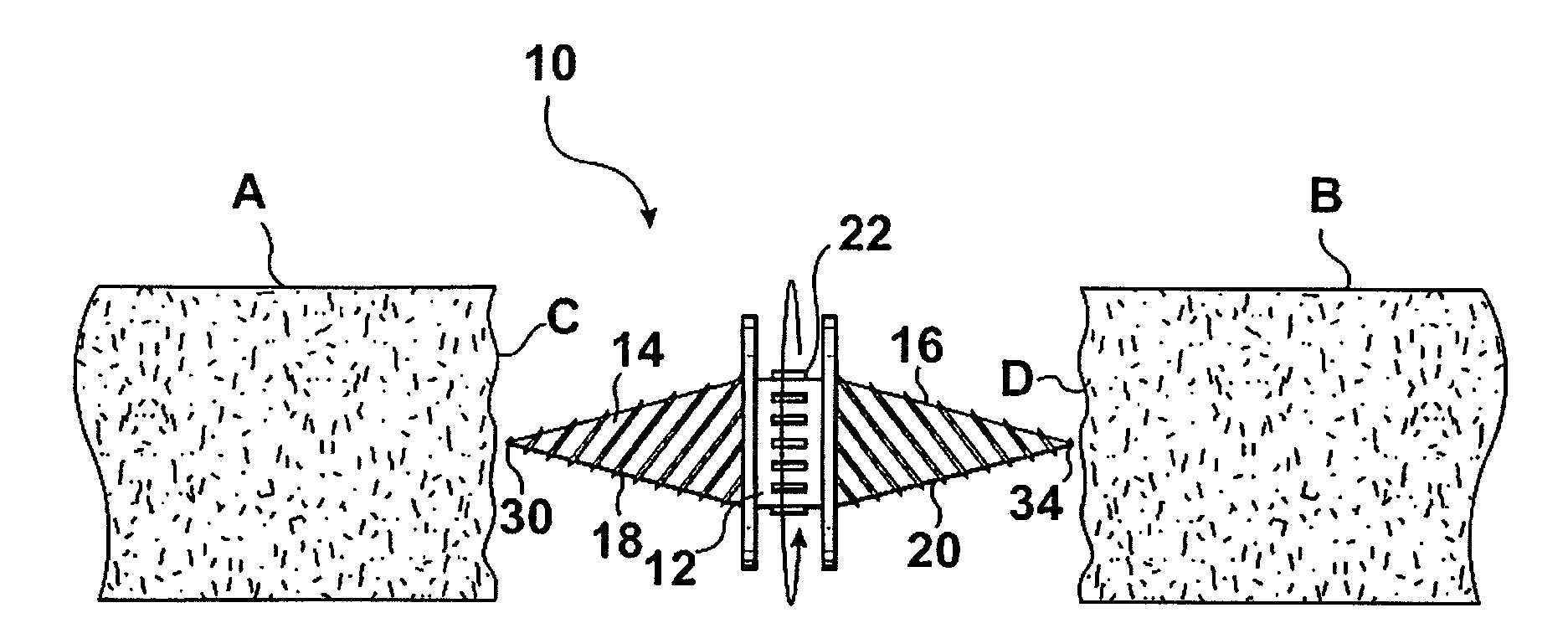 Double threaded tissue tack