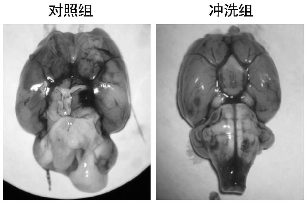 Application of Colloidal Gold in Preparation of Artificial Cerebrospinal Fluid Reagent