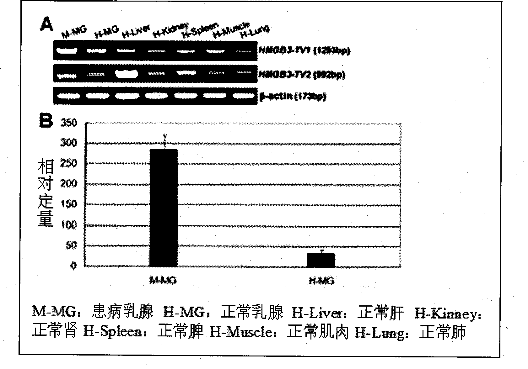 Core promoter for influencing cow mastitis infectibility/resistance HMGB3 gene and functional molecule mark and application