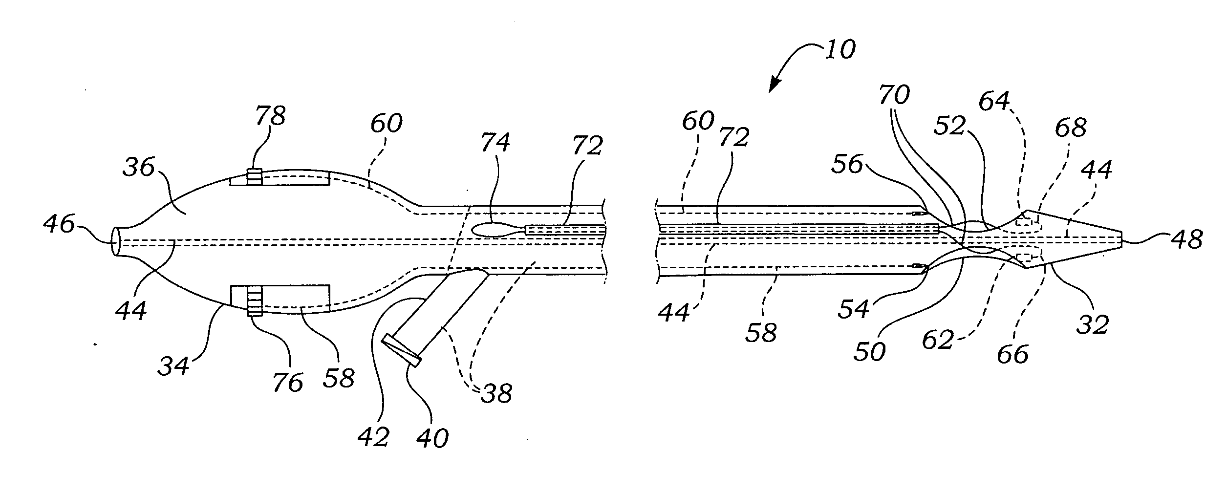 System, apparatus, and method for repairing septal defects