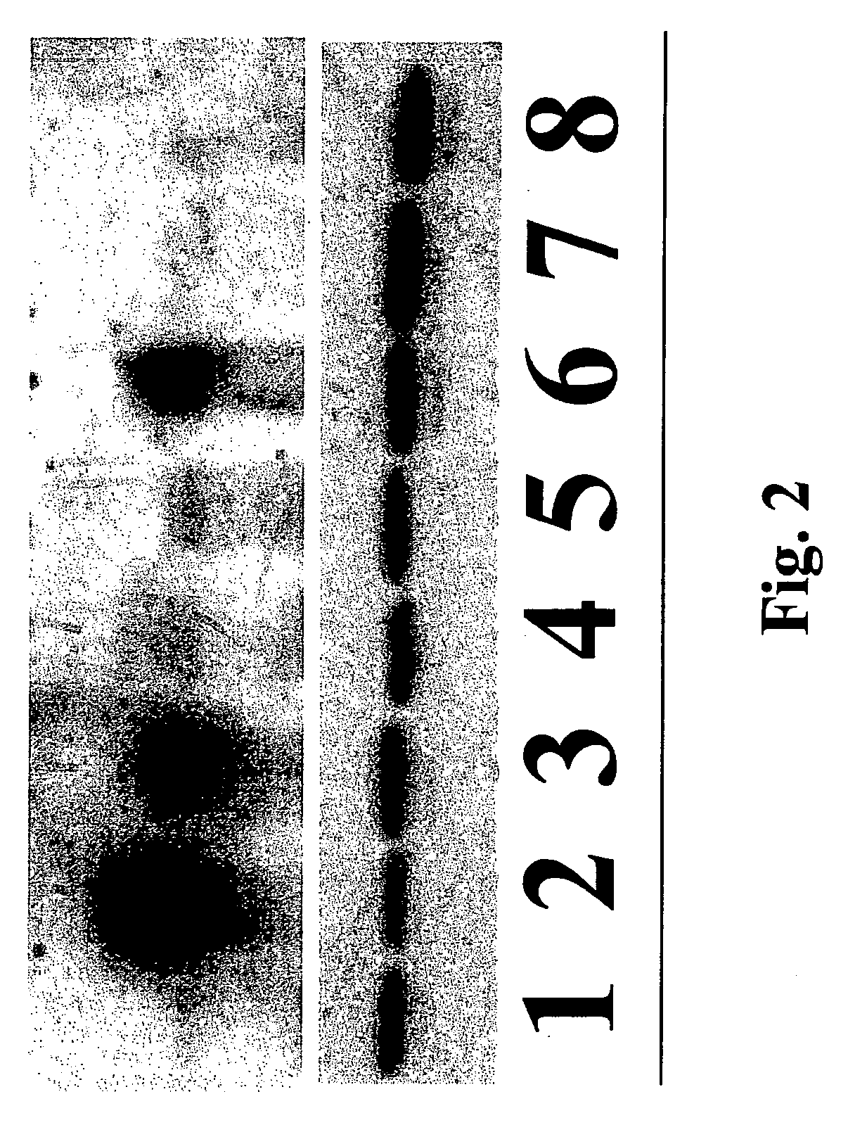 Design of novel drug screens based on the newly found role of dystroglycan proteolysis in tumor cell growth