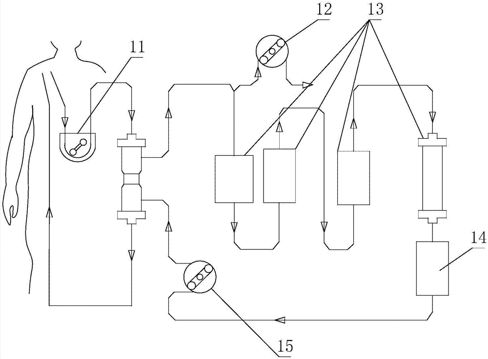 Wearable artificial kidney