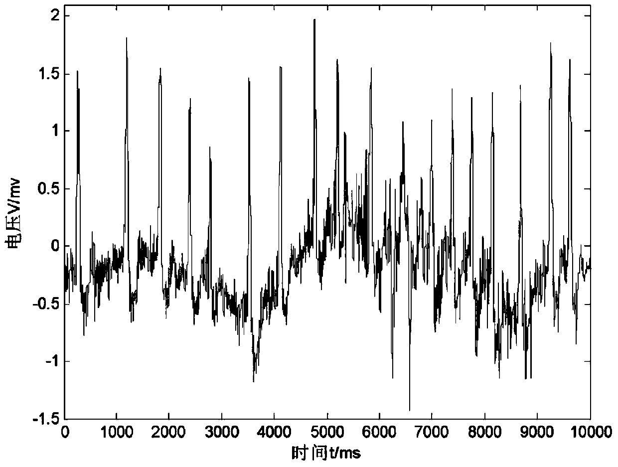 Electrocardiosignal denoising method based on morphology and EMD (empirical mode decomposition) wavelet threshold value