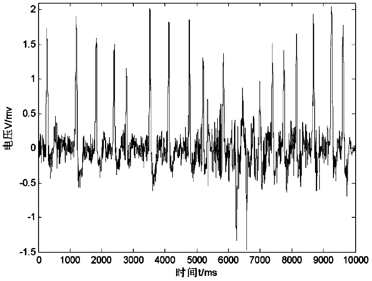 Electrocardiosignal denoising method based on morphology and EMD (empirical mode decomposition) wavelet threshold value