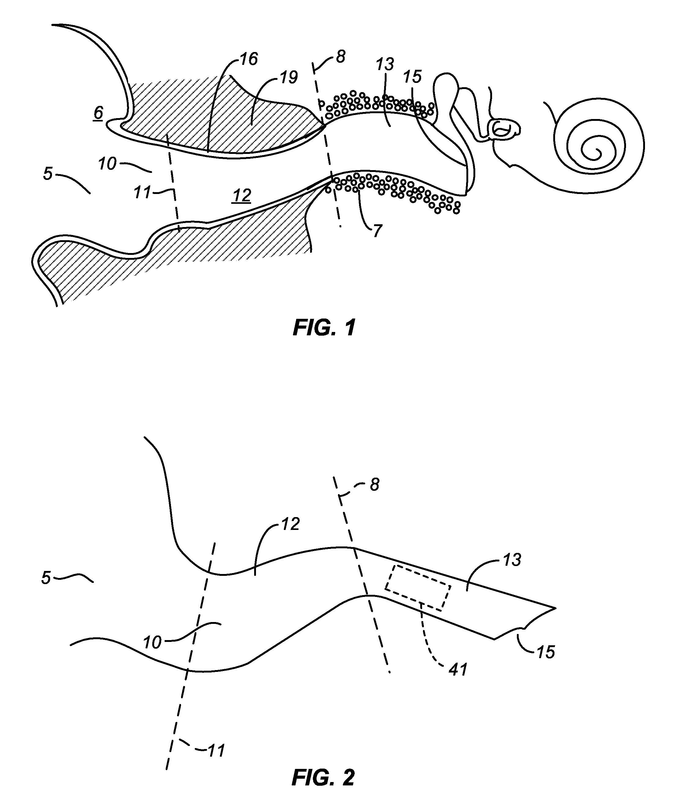 Canal hearing device with disposable battery module