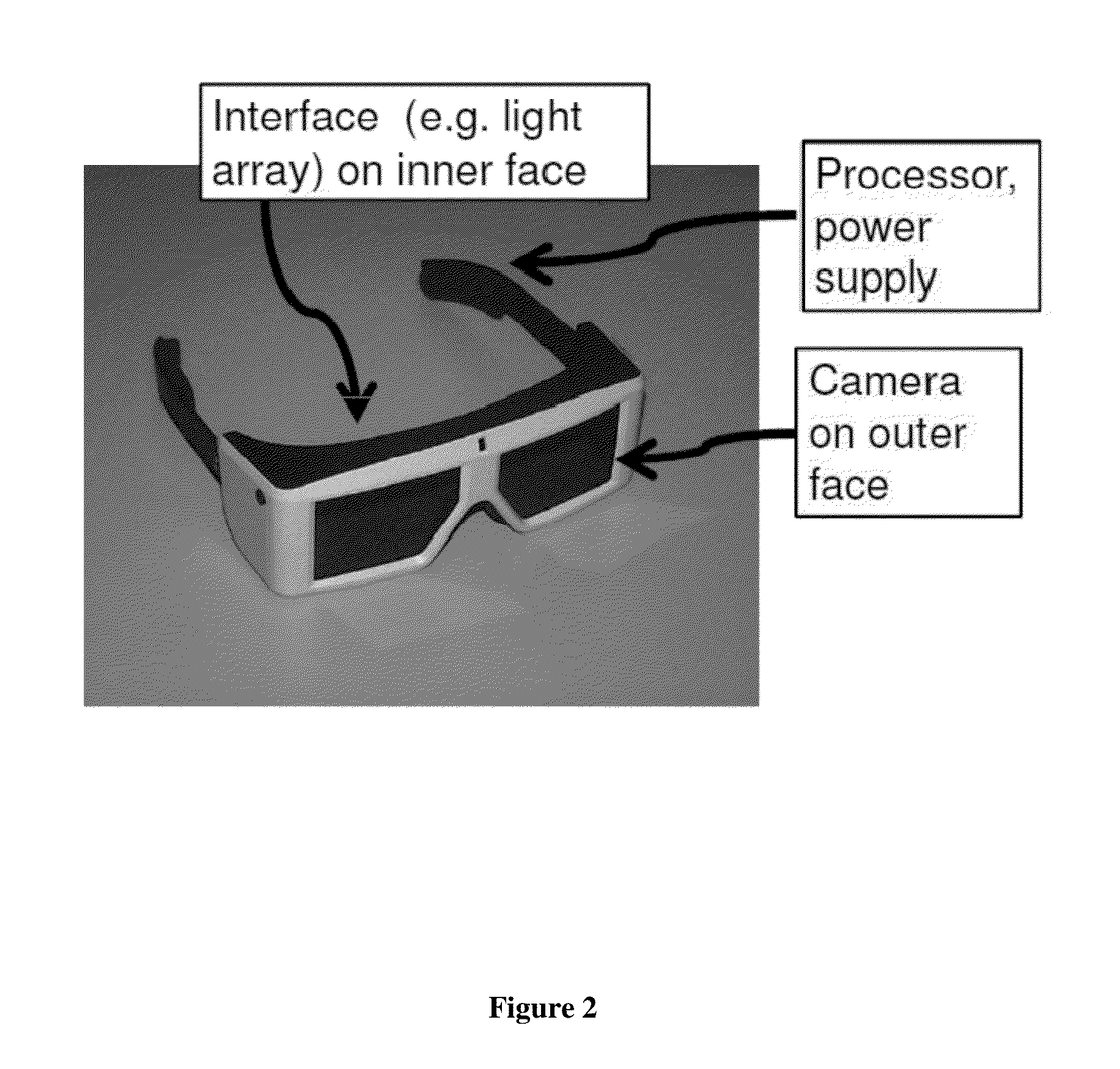 Retina prosthesis