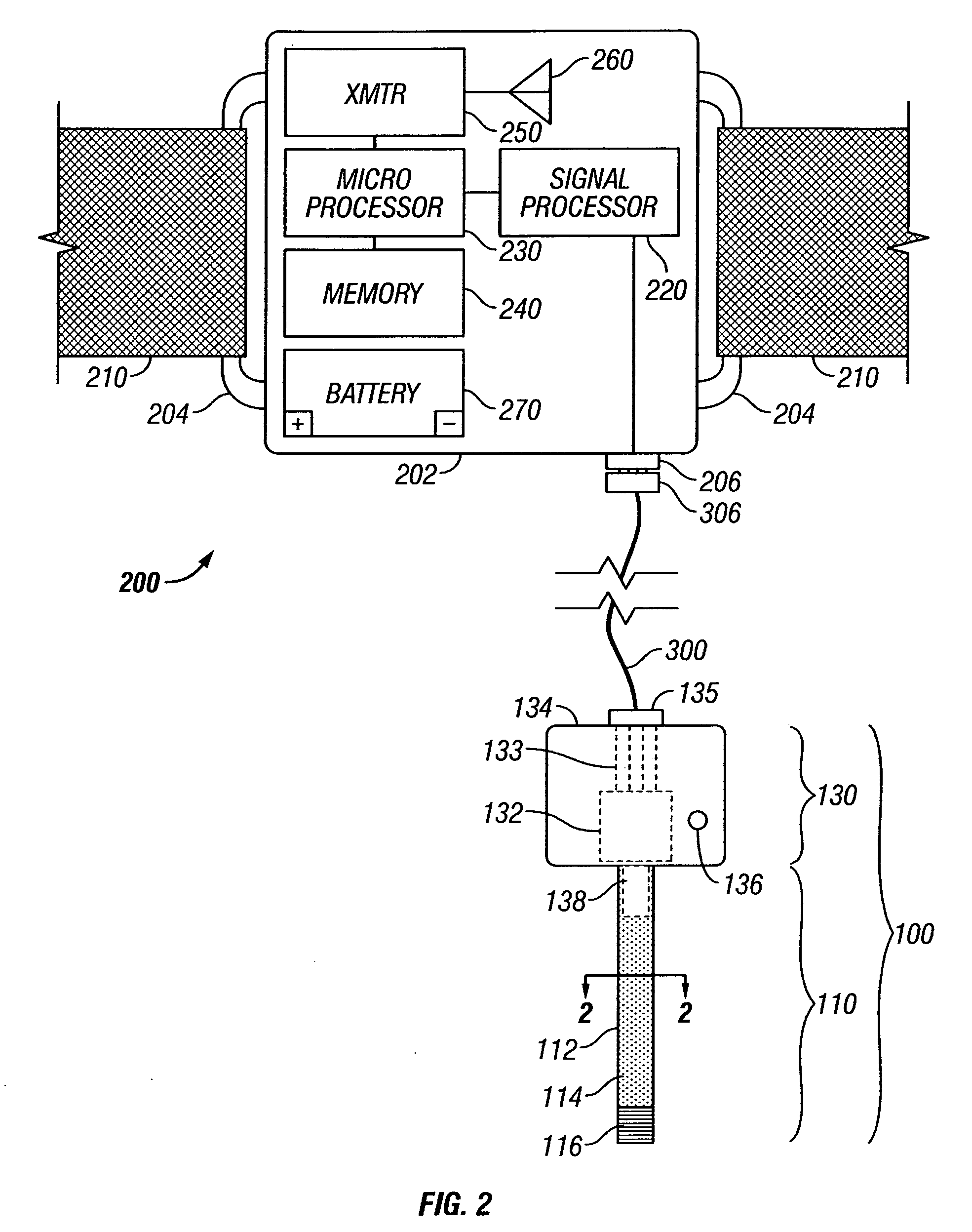 Vascular blood pressure monitoring system with transdermal catheter and telemetry capability