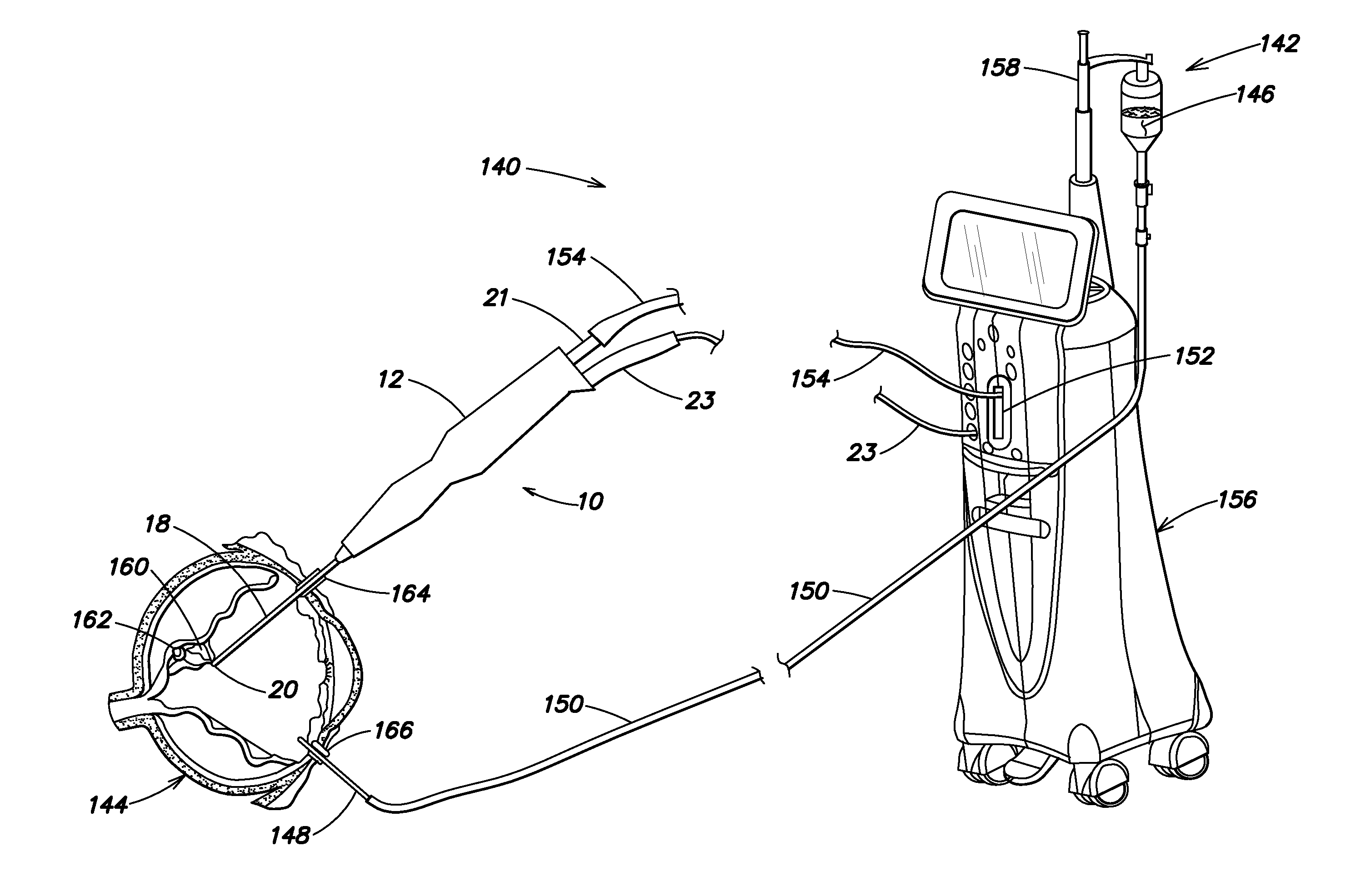 Vibrating Surgical Device for Removal of Vitreous and Other Tissue