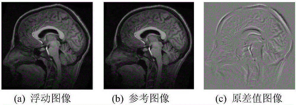 Non-rigid image registration method based on image feature and Demons